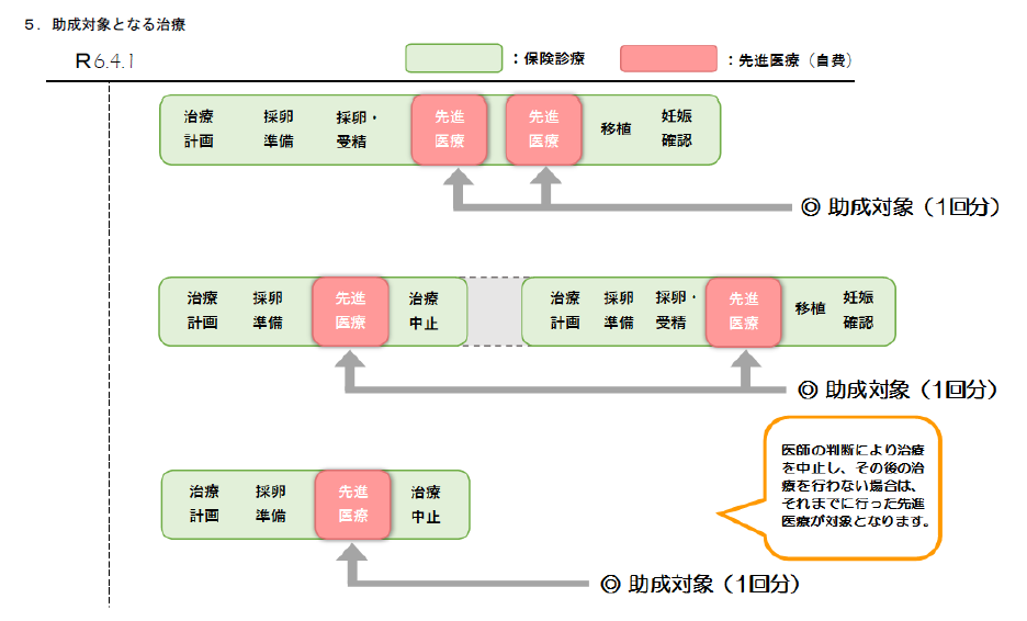 1回の治療の考え方